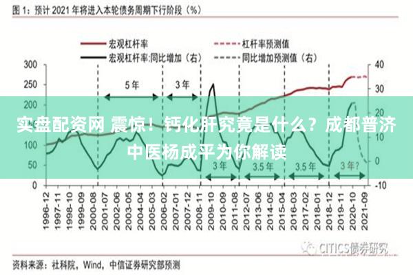 实盘配资网 震惊！钙化肝究竟是什么？成都普济中医杨成平为你解读